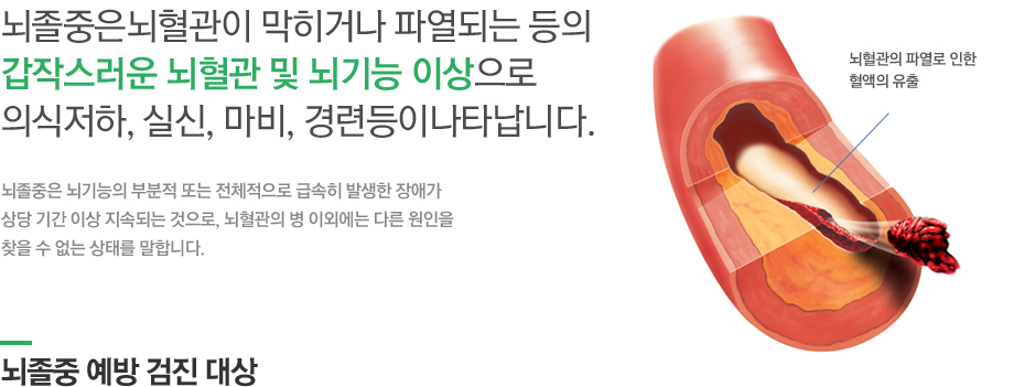 뇌졸중은뇌혈관이 막히거나 파열되는 등의 갑작스러운 뇌혈관 및 뇌기능 이상으로 의식저하, 실신, 마비, 경련등이나타납니다. 뇌졸중은 뇌기능의 부분적 또는 전체적으로 급속히 발생한 장애가 상당 기간 이상 지속되는 것으로, 뇌혈관의 병 이외에는 다른 원인을 찾을 수 없는 상태를 말합니다. 