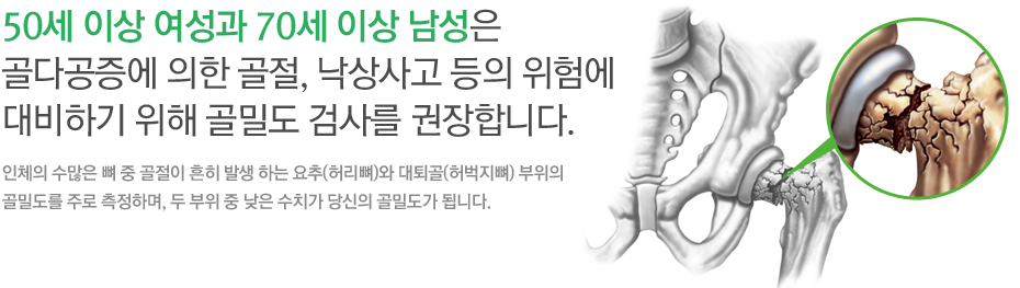 50세 이상 여성과 70세 이상 남성은 골다공증에 의한 골절, 낙상사고 등의 위험에 대비하기 위해 골밀도 검사를 권장합니다. 인체의 수많은 뼈 중 골절이 흔히 발생 하는 요추(허리뼈)와 대퇴골(허벅지뼈) 부위의 골밀도를 주로 측정하며, 두 부위 중 낮은 수치가 당신의 골밀도가 됩니다. 